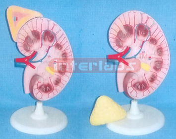 SUPER KIDNEY ANATOMICAL ENLARGED MODEL (3 PCS)